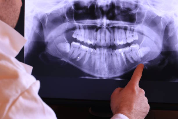 Best Emergency Denture Repair in Millers Creek, NC